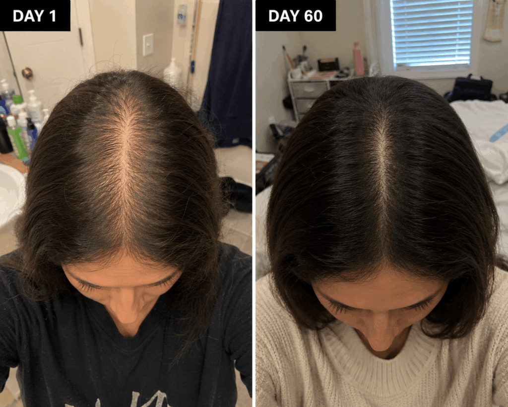Before and After